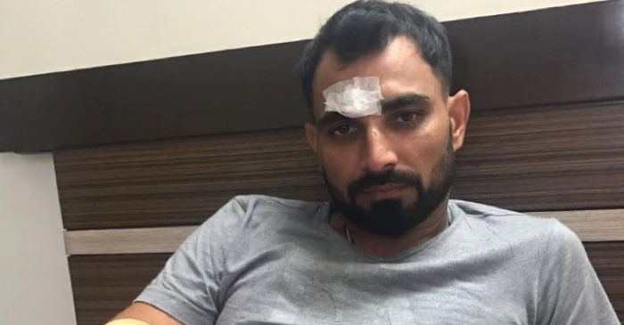 Team India cricketers wish Mohammad Shami a speedy recovery after the pacer’s road accident
