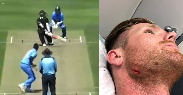 James Neesham lampoons himself after hurting his chin against India A
