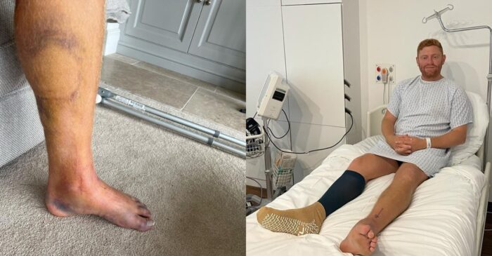 ‘You wonder whether or not you will be able to walk again’: Jonny Bairstow opens up about horrific leg injury